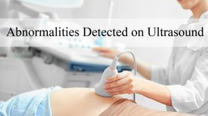 abnormalities-detected-on-ultrasound